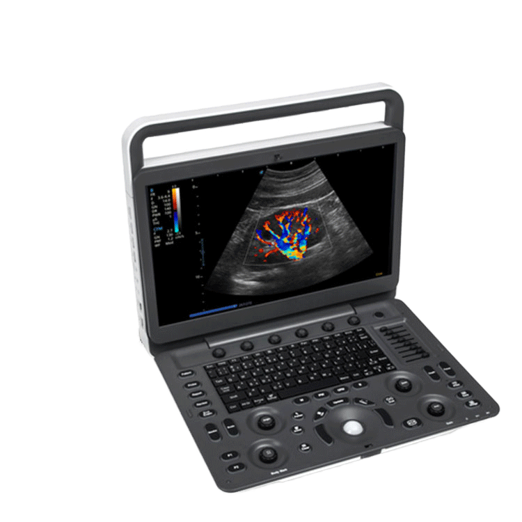 162-HY-M60 2024 Portable 3D Doppler Ultrasound Scanner Machine New Version Laptop Compatibility Color Me.jpg